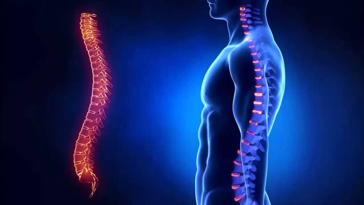 Osteokondroza se klasificira prema dijelovima kralježnice u kojima se bolest razvija.