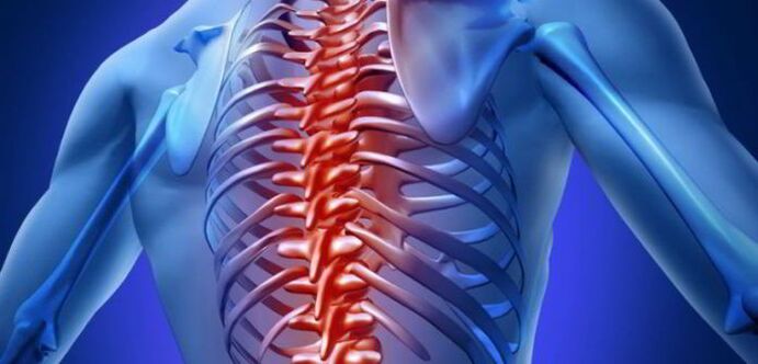 osteohondroza torakalne kralježnice